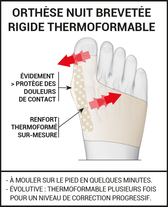 Offre Duo web orthèse hallux valgus nuit
