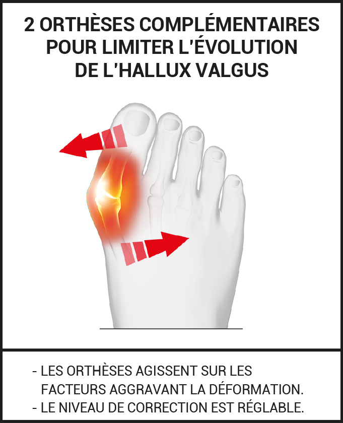 Offre Duo web orthèse hallux valgus jour et nuit