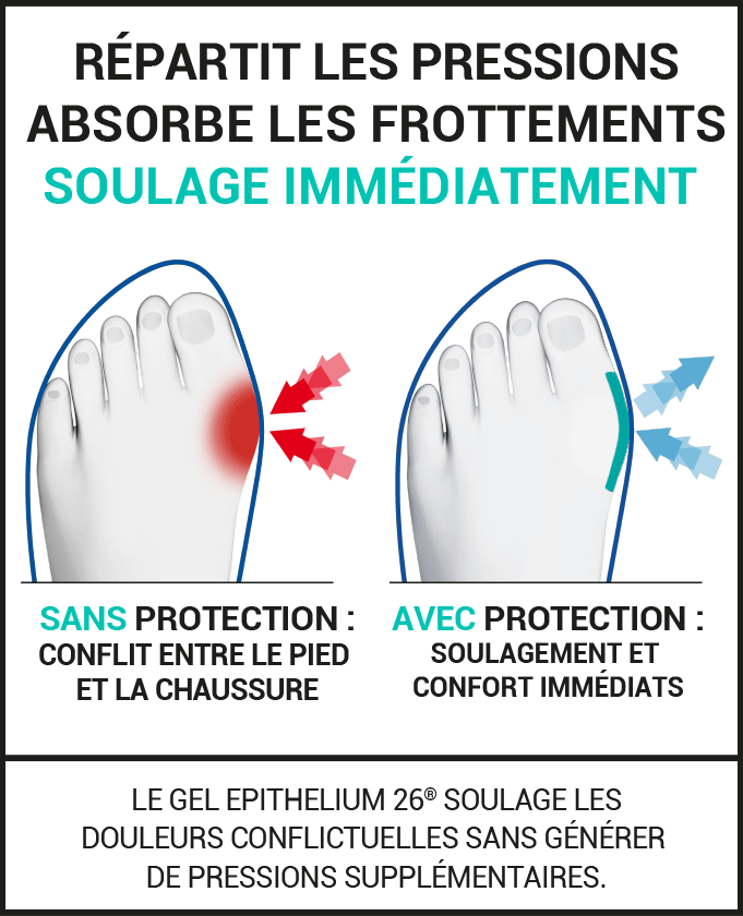 Protection quotidienne pour l’Hallux Valgus