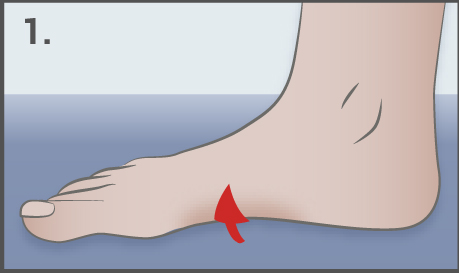 The foot short exercise - hallux valgus