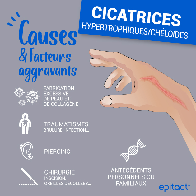 Cicatrices chéloïdes & hypertrophiques : causes et facteurs aggravants