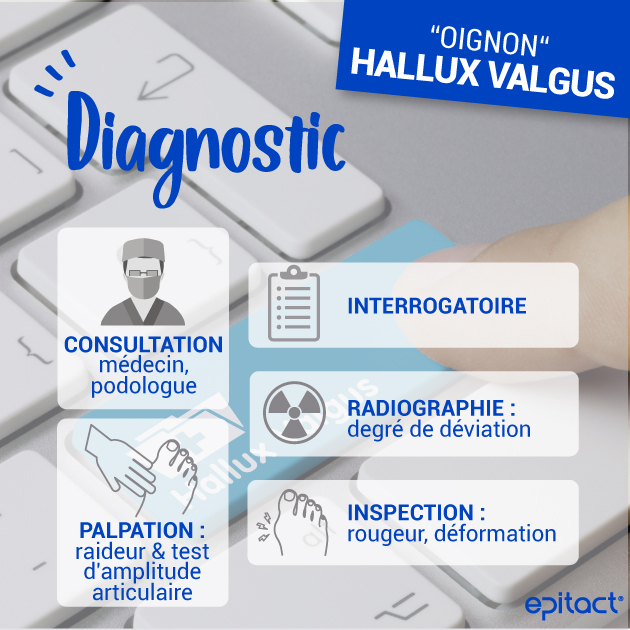 Diagnostic - hallux valgus