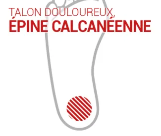epine-calcaneenne