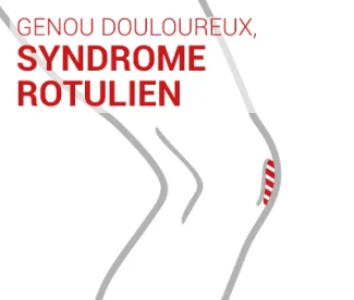 Syndrome rotulien, Genou douloureux