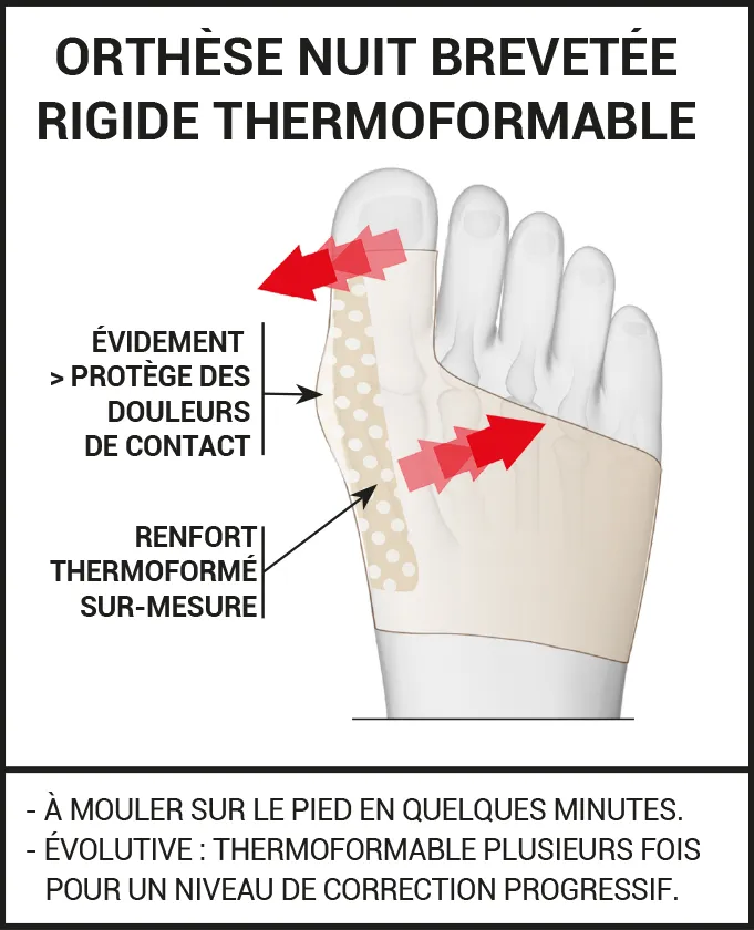 Offre Duo web orthèse hallux valgus nuit