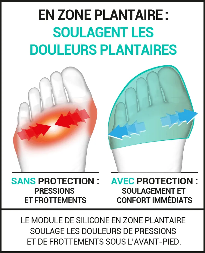 douleurs plantaires Hallux valgus Quintus varus orteils en marteau