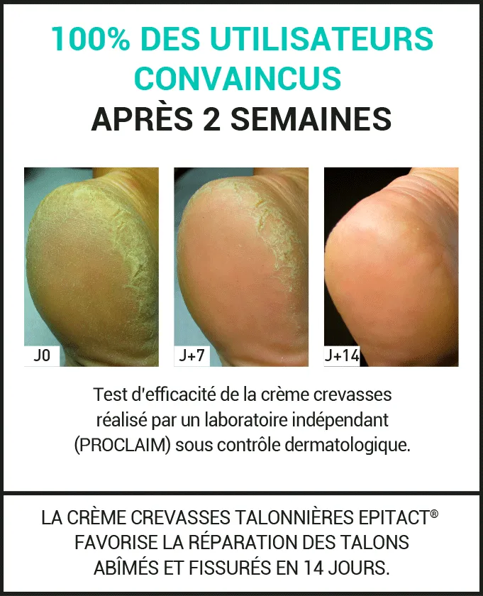creme crevasses talon epitact