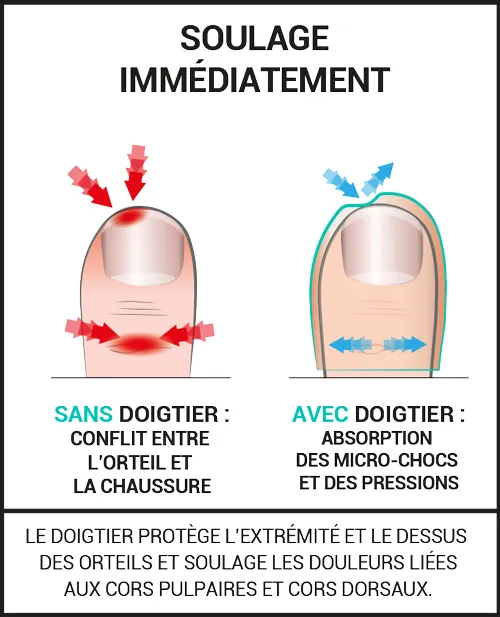 Protections pour les cors pulpaires et dorsaux