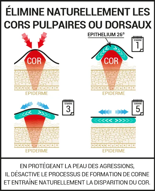 Protections pour les cors pulpaires et dorsaux