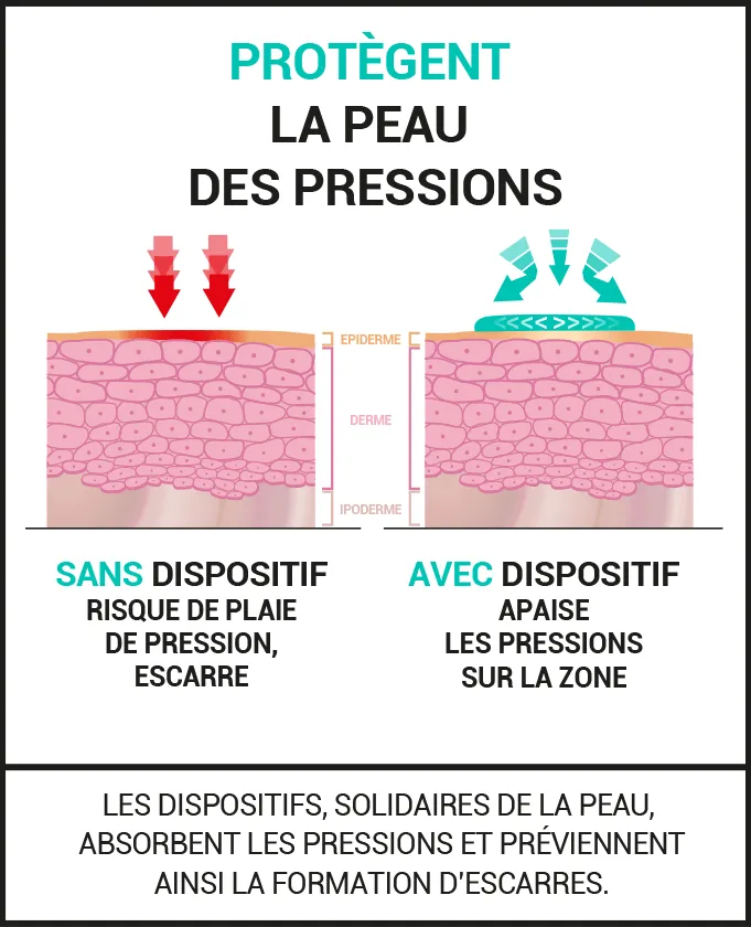 Protection universelle d’aide à la prévention des plaies de pression, escarres