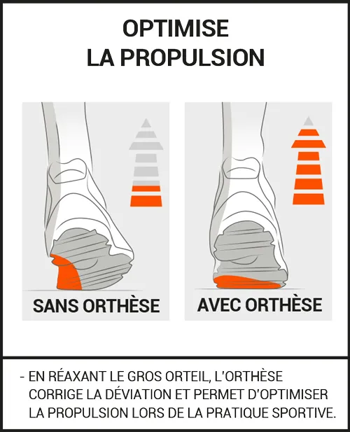 Orthèse Hallux Valgus SPORT