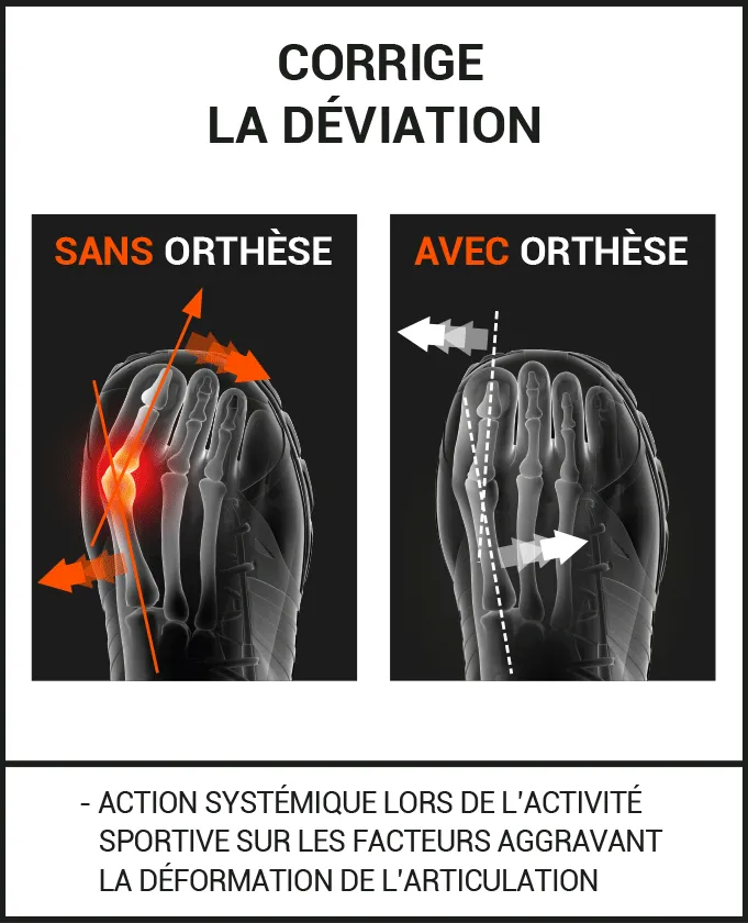 Orthèse Hallux Valgus SPORT