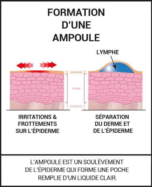 Protègent des frottements, préviennent les ampoules et soulagent la douleur.