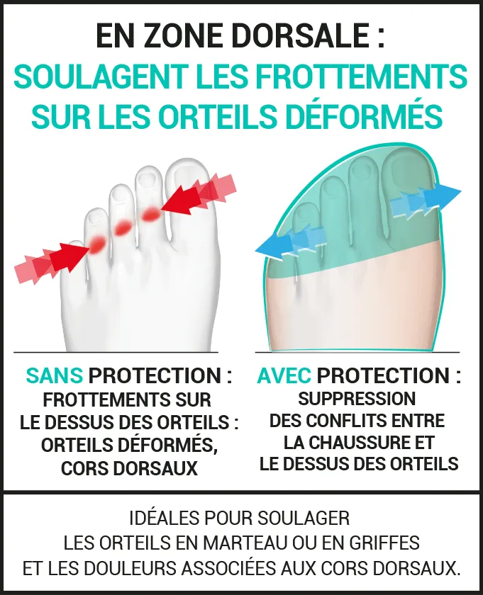 Protections multi-zones : orteils et avant-pieds !