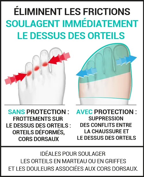 protection-orteils-en-marteau