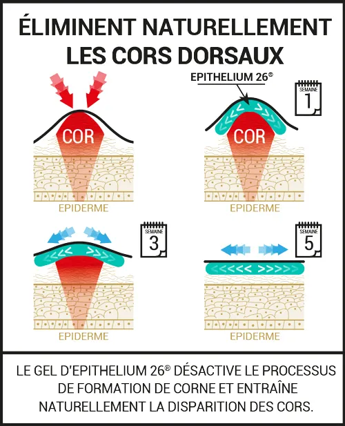 Epitact protège-pointes orteils en marteau taille M x2