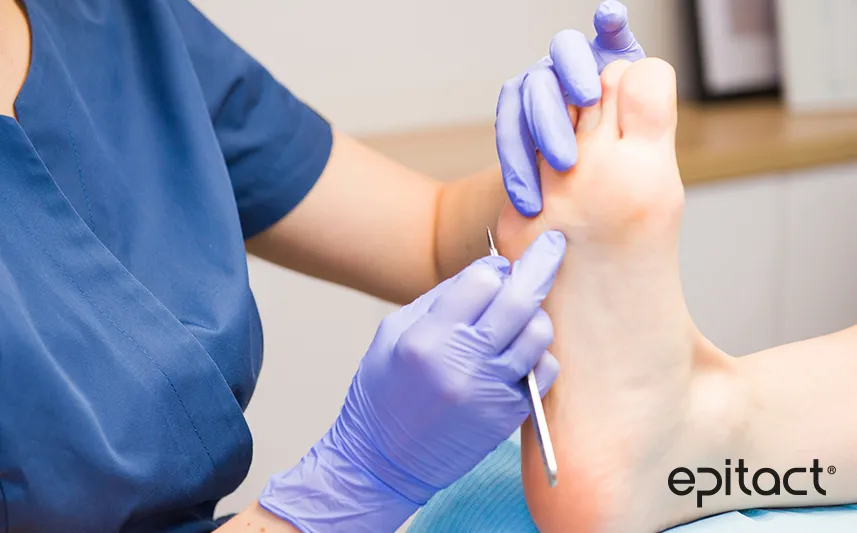 Comment soulager un cor au pied douloureux et éviter l'inflammation ?
