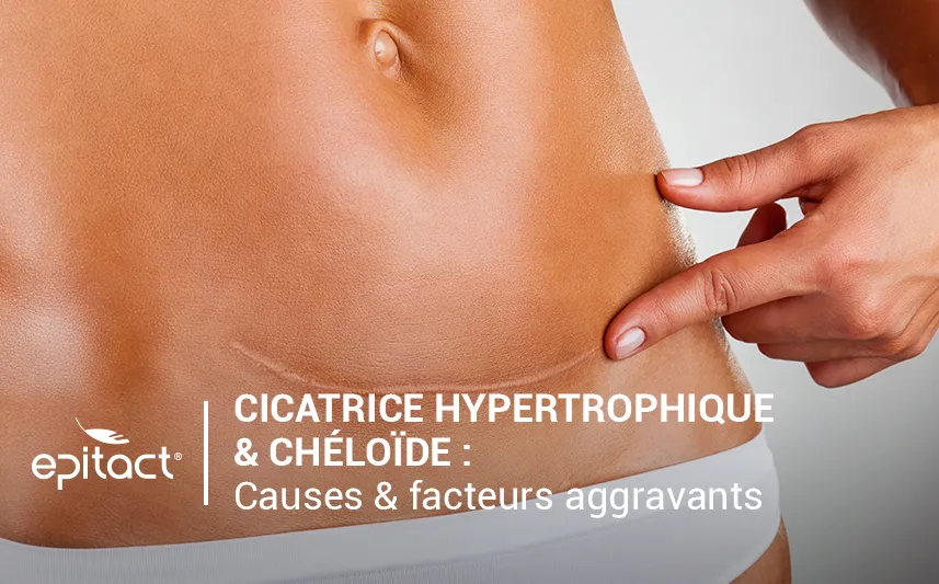 Cicatrices chéloïdes & hypertrophiques : causes et facteurs aggravants