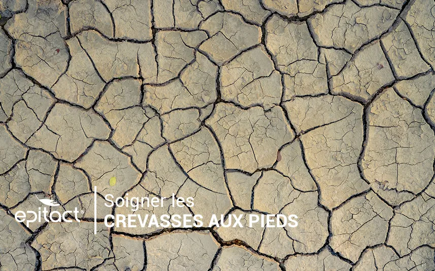 Quel soin contre les pieds secs & crevasses ?