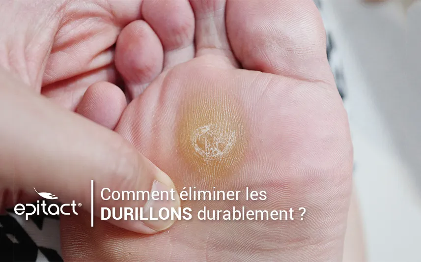 Enlever durablement un durillon sous le pied