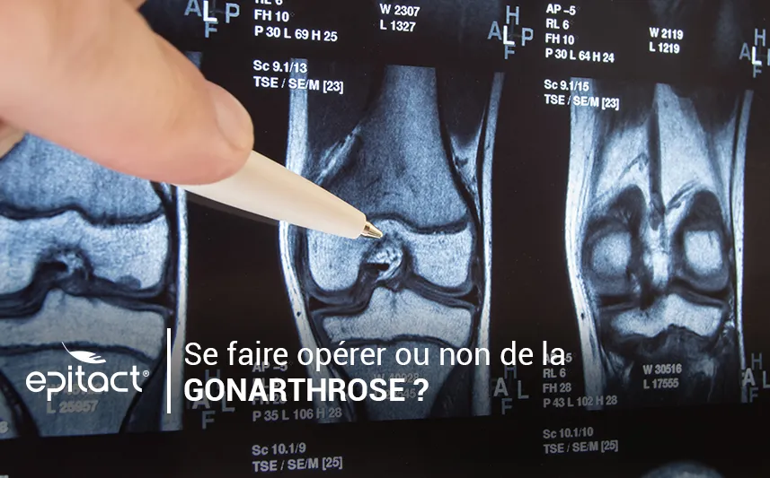 Intervention chirurgicales fréquentes contre la gonarthrose