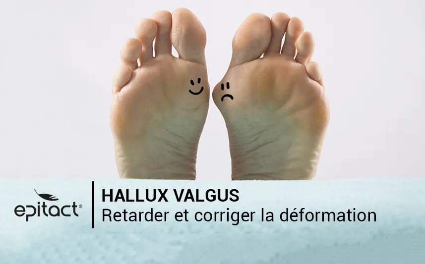 Comment réduire la déformation de l'hallux valgus EPITACT®