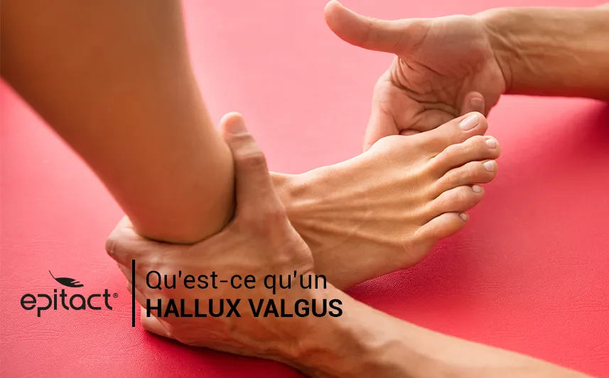 Qu'est-ce qu'un hallux valgus ou « oignon » au pied par EPITACT®