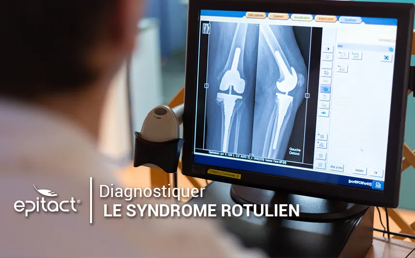 Diagnostiquer le syndrome rotulien