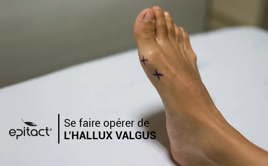 Se faire opérer d’un hallux valgus
