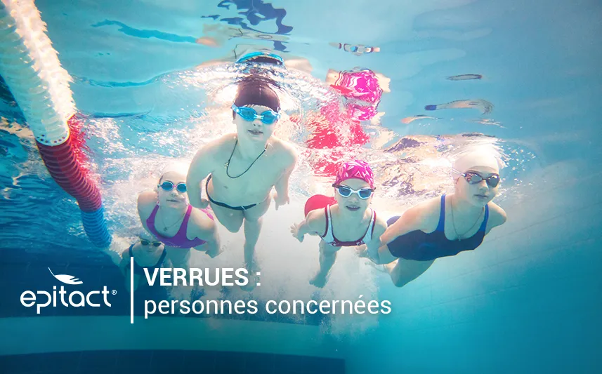 Verrues plantaires : étiologie, qui est concerné ?