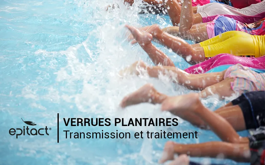 Traitement et transmission des verrues plantaires