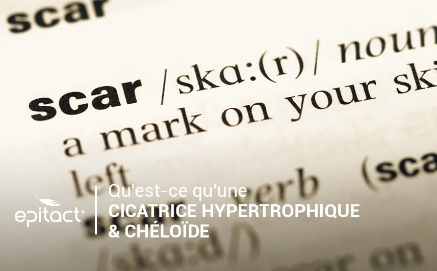 Cicatrices chéloïdes & hypertrophiques : définition