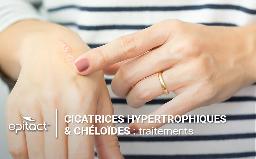 Les traitements des cicatrices hypertrophiques & chéloïdes