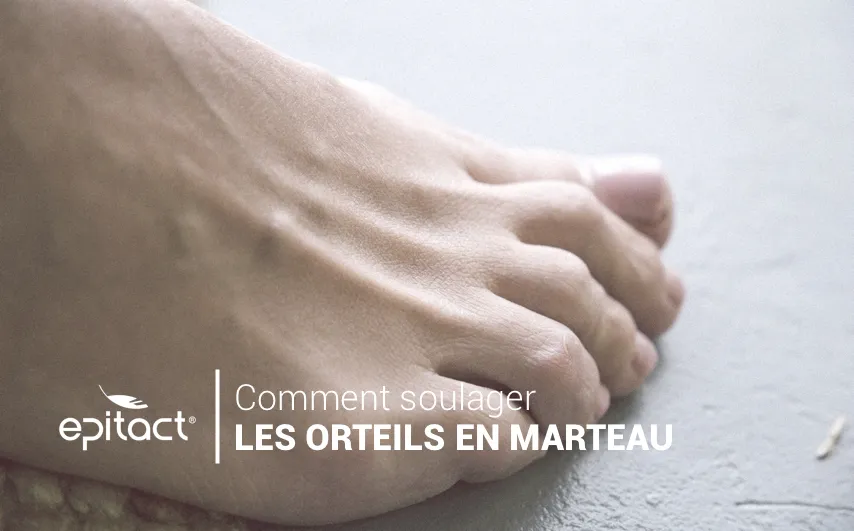 Comment soulager les orteils en marteau