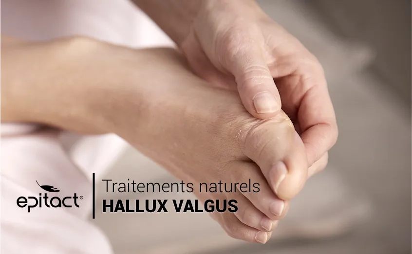 Traitements naturels pour soulager l'hallux valgus | EPITACT®